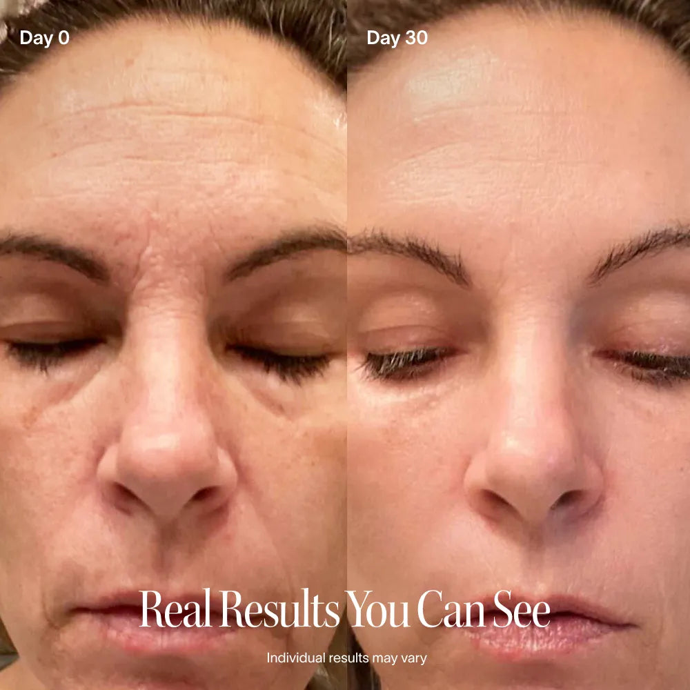 On the Go 4-in-1 Red Light Therapy Wand & Activating Serum Kit