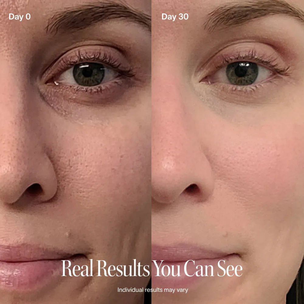 On the Go 4-in-1 Red Light Therapy Wand & Activating Serum Kit